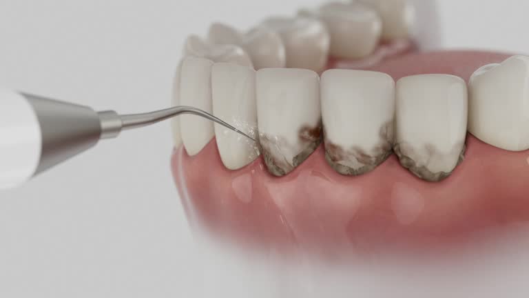 Trusted Dental Implants service in Las Vegas, NV - Dentist Open Now